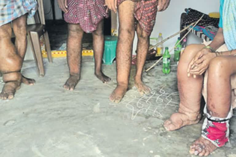 Filariasis patients problems in pedapenki at parvathipuram manyam district