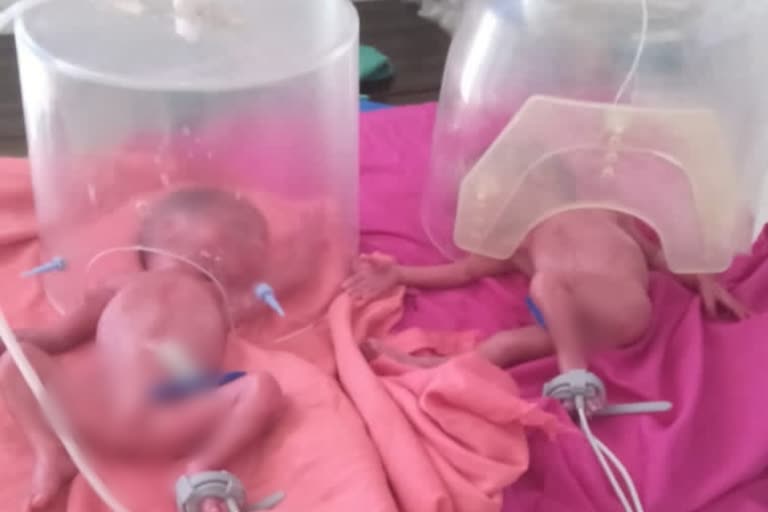 woman gave birth to five children two survived and three died  woman gave birth to five children in Rajasthan karauli  pre mature delivery death  ഒറ്റ പ്രസവത്തിൽ 5 കുഞ്ഞുങ്ങൾ  ഒറ്റ പ്രസവത്തിൽ 5 കുഞ്ഞുങ്ങൾക്ക് ജന്മം നൽകി യുവതി  മാസം തികയാതെയുള്ള പ്രസവത്തിൽ മൂന്ന് കുഞ്ഞുങ്ങൾ മരിച്ചു  മാസം തികയാതെയുള്ള പ്രസവം