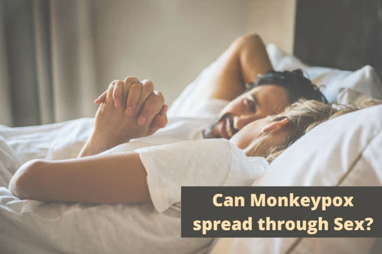 Monkeypox, what causes Monkeypox, can Monkeypox spread through sex, Monkeypox cases india