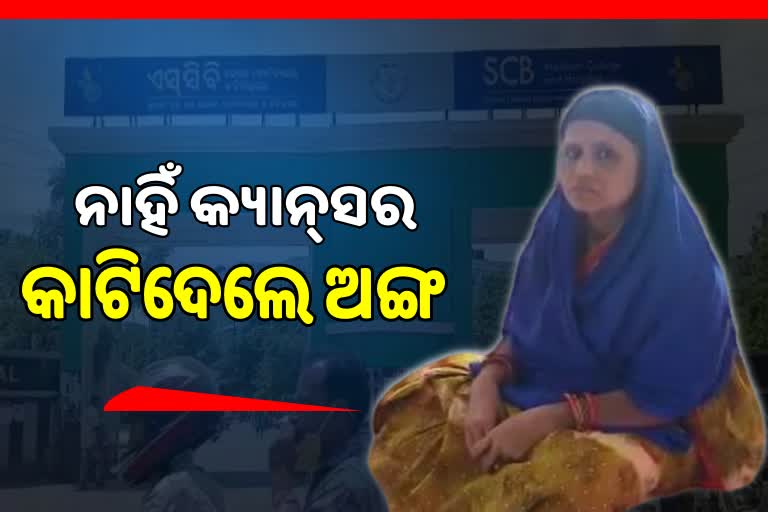 SCBରେ ଅବହେଳା: କ୍ୟାନସର ହୋଇନି କାଟିଦେଲେ ଅଙ୍ଗ, କେମୋ ଦେଇଥିବା ଅଭିଯୋଗ