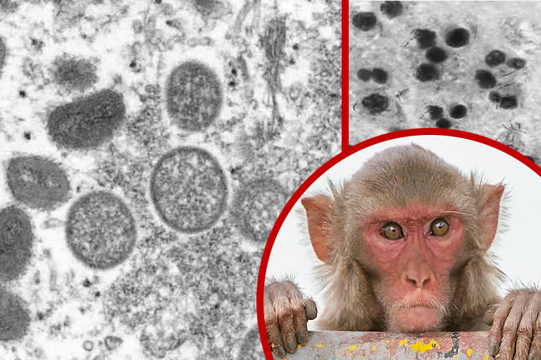 monkeypox strain in india