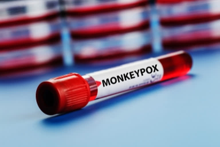 monkeypox india death