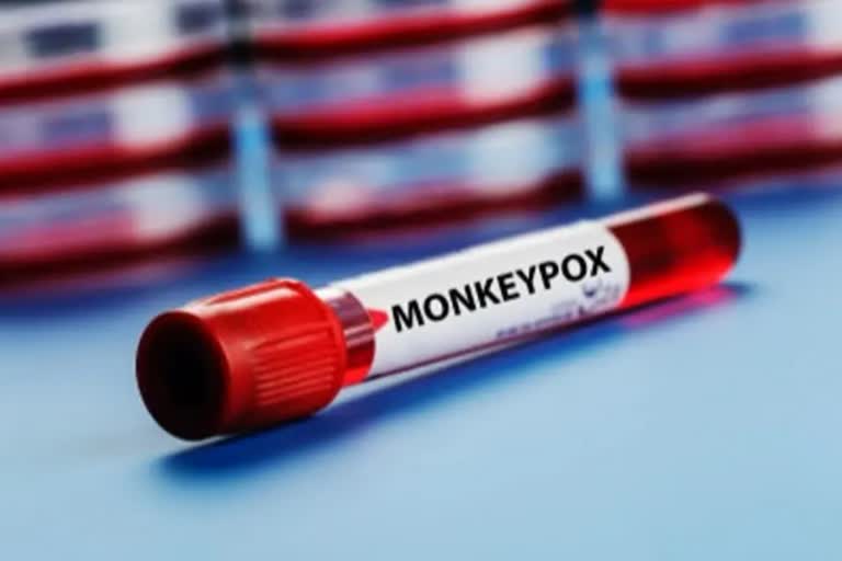 suspected monkeypox death reported in Kerala
