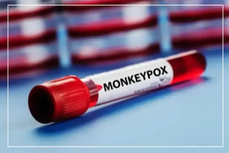 Monkeypox in India