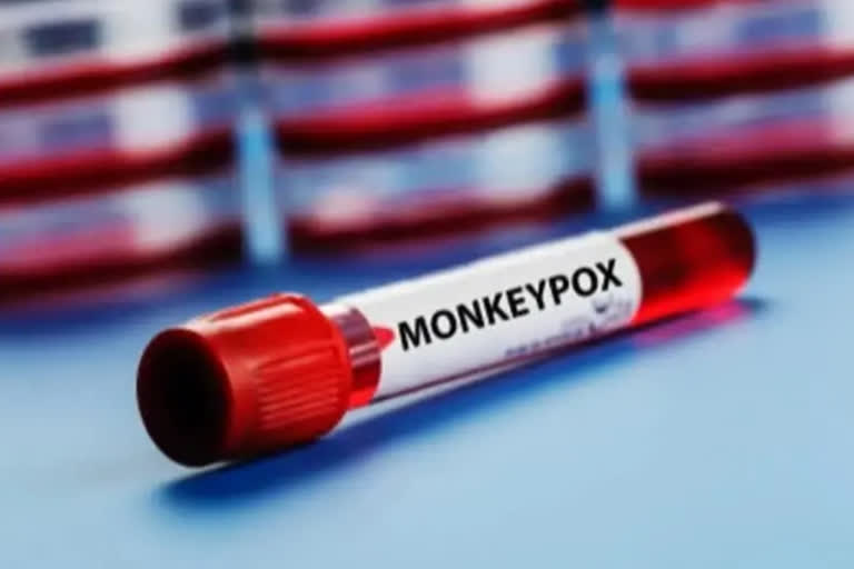 monkeypox-found-in-samples-of-deceased-kerala-youth