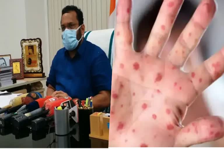 minister k rajan response monkey pox death  monkey pox death Trissur  first monkey pox death in india  kerala minister k rajan  revenue minister k rajan  രാജ്യത്തെ ആദ്യത്തെ മങ്കിപോക്‌സ് മരണം  ആശങ്കപ്പെടേണ്ട സാഹചര്യമില്ലെന്ന് മന്ത്രി കെ രാജന്‍  റവന്യൂ വകുപ്പ് മന്ത്രി കെ രാജന്‍  മങ്കിപോക്‌സ് മരണം