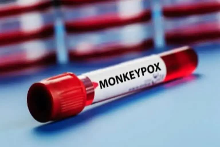 Kerala Monkeypox Positive