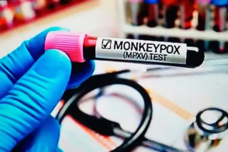 Monkeypox