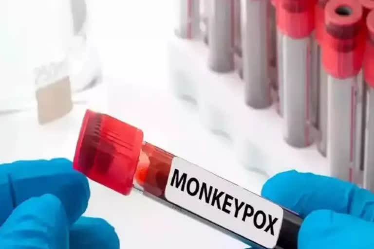 monkey pox
