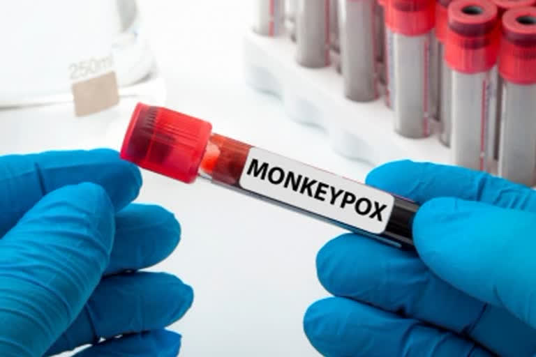 Suspected symptoms of monkeypox in a medical student in Visakhapatnam