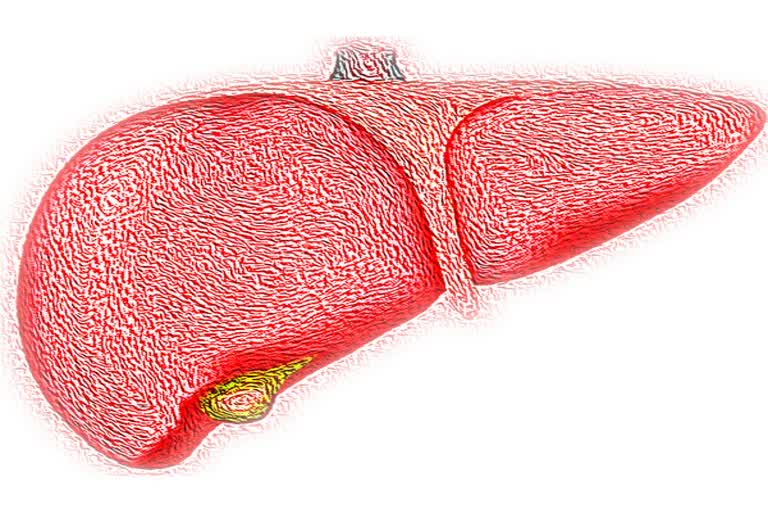 non alcoholic fatty liver disease  vitamin B to treat fatty liver disease  നോൺ ആൽക്കഹോളിക് ഫാറ്റി ലിവർ  വിറ്റാമിൻ ബി 12  ഹോമോസിസ്റ്റീൻ അമിനോ ആസിഡ്  ആൽക്കഹോളിക് ഇതര ഫാറ്റി ലിവർ രോഗം  NASH  NASH vitamin B treatment  നോൺ ആൽക്കഹോളിക് സ്റ്റീറ്റോഹെപ്പറ്റൈറ്റിസ്  സിന്‍റാക്‌സിൻ 17