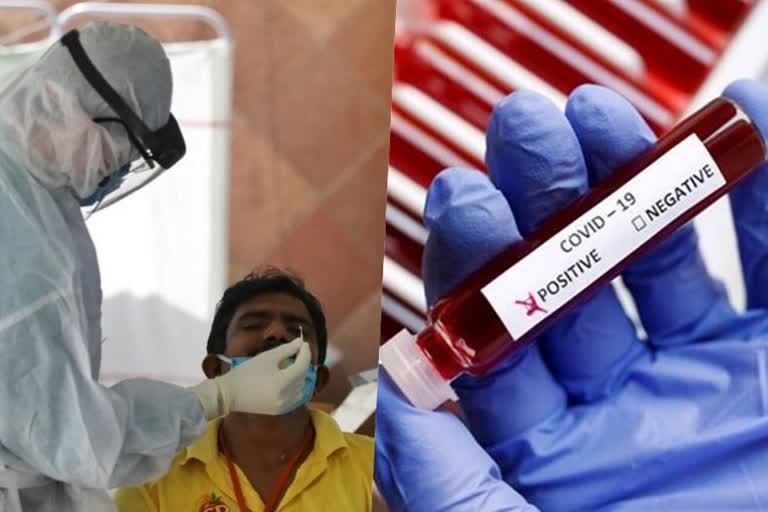 Covid Cases in India  Covid Cases in India Latest Updates  Slight Decline on Covid cases in India  Latest Health News  Latest National News  Covid Updates  National Health Ministry  രാജ്യത്തെ കൊവിഡ് കേസ്  ഇന്നത്തെ കൊവിഡ് കേസുകള്‍  രാജ്യത്തെ കൊവിഡ് കേസില്‍ നേരിയ കുറവ്  കൊവിഡ് രോഗമുക്തി നിരക്ക്  ഇന്ത്യയില്‍ കഴിഞ്ഞ 24 മണിക്കൂറില്‍ കൊവിഡ് കേസുകള്‍  ഇന്ത്യയിലെ പുതിയ കൊവിഡ് കേസുകള്‍  നിലവില്‍ രാജ്യത്തെ സജീവ കൊവിഡ് കേസുകളുടെ എണ്ണം  ആരോഗ്യ കുടുംബക്ഷേമ മന്ത്രാലയം  ആകെ മൊത്തം സുഖം പ്രാപിച്ചവര്‍  കൊവിഡ് വാക്‌സിനേഷന്‍  Covid vaccination  പുതിയ കേസുകള്‍