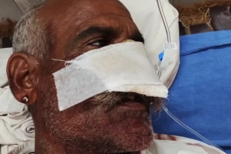 Old man nose nose chopped off due to break engagement in Bikaner