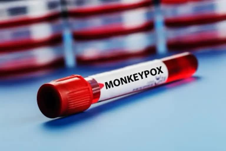 monkeypox