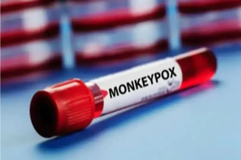 Monkeypox Lack of treatment guideline News