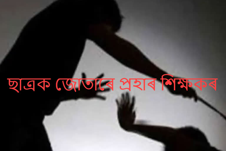 তৃতীয় শ্ৰেণীৰ ছাত্ৰক জোতাৰে পিতিলে শিক্ষকে