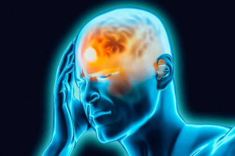 brain-cyst-could-be-behind-chronic-headache-nausea-say-doctors