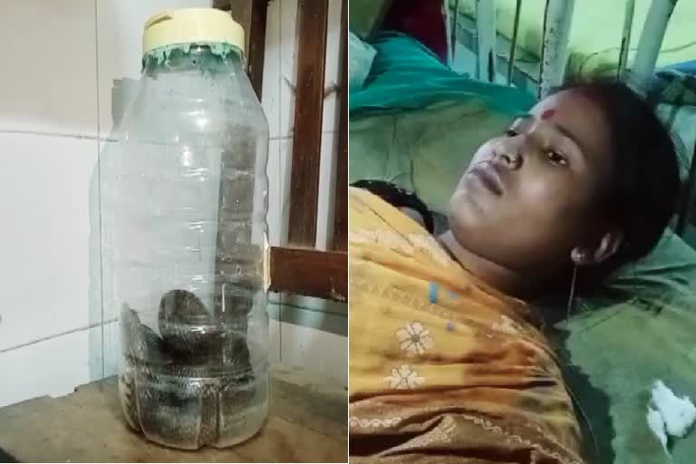 Woman Reaches to Tufanganj Hospital With a Snake Which is Bites Her