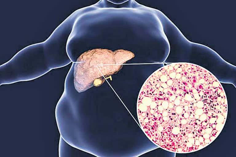 Vitamin b12 and folate benefit in fatty liver disease says journal of hepatology