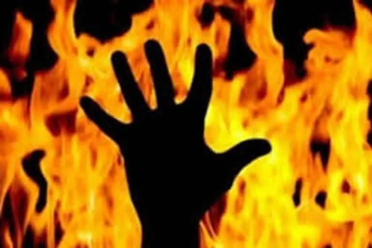 Teenager Burnt Alive