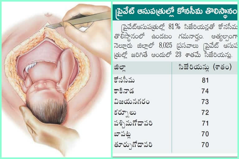 Cesareans