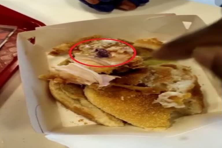 Glove in KFC burger - customers shockedEtv Bharat