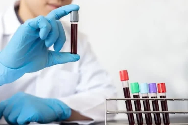 A blood test that detects many types of cancer