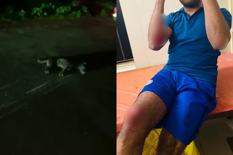 Kozhikode stray dog attack bikers injured  bikers injured in stray dog attack at Kozhikode  ബൈക്ക് യാത്രികർക്ക് നേരെ കുതിച്ചുചാടി തെരുവുനായ  യാത്രക്കാർക്ക് പരിക്ക്  ബൈക്കിനടിയിൽപ്പെട്ട നായ ചത്തു  തെരുവുനായ ആക്രമണത്തിൽ ബൈക്ക് യാത്രികർക്ക് പരിക്ക്  കോഴിക്കോട് തെരുവ് നായ ആക്രമണം  street dog attack kerala  stray dog nuisance  കേരള പേപ്പട്ടി ശല്യം  തെരുവ് നായ ശല്യം  തെരുവുനായ ബൈക്കിന് മുകളിലേക്ക് ചാടി