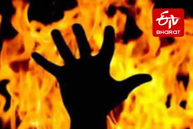 teenager burnt after gangrape in Pilibhit