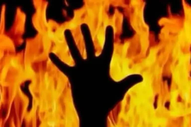 Mother torched alive by son