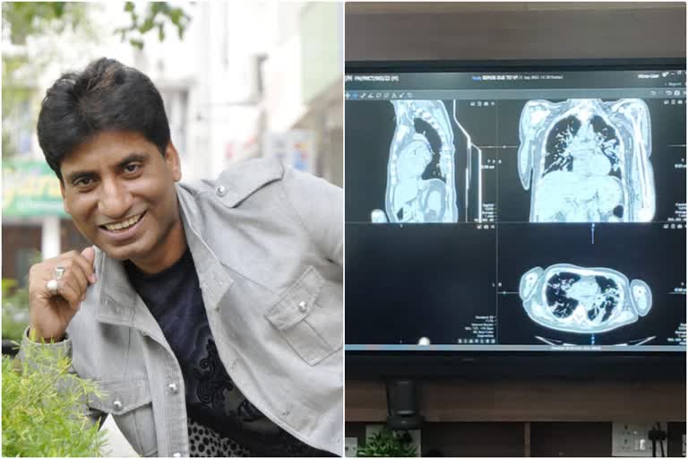 Delhi AIIMS hospital  Raju Srivastav postmortem without surgery  AIIMS new forensic technology for postmortem  All India Institute of Medical Science  ನಕ್ಕು ನಲಿಸಿದ ಹಾಸ್ಯಗಾರನಿಗೆ ಕಣ್ಣೀರನ ವಿದಾಯ  ಹಾಸ್ಯನಟ ರಾಜು ಶ್ರೀವಾಸ್ತವ್ ಮರಣ  ನೂತನ ತಂತ್ರಜ್ಞಾನದಿಂದ ಹ್ಯಾಸನಟನ ಮರಣೋತ್ತರ ಪರೀಕ್ಷೆ  ಅಖಿಲ ಭಾರತ ವೈದ್ಯಕೀಯ ವಿಜ್ಞಾನ ಸಂಸ್ಥೆ  ಏಮ್ಸ್ ವಿಧಿವಿಜ್ಞಾನ ವಿಭಾಗದ ಮುಖ್ಯಸ್ಥ  ಮರಣೋತ್ತರ ಪರೀಕ್ಷೆಗೆ ನೂತನ ತಂತ್ರಜ್ಞಾನ ಬಳಕೆ  ರಾಜು ಶ್ರೀವಾಸ್ತವ್ ಮರಣೋತ್ತರ ಪರೀಕ್ಷೆ ಏಕೆ  ಏಮ್ಸ್​ ಆಸ್ಪತ್ರೆಯಲ್ಲಿ ರಾಜು ಶ್ರೀವಾಸ್ತವ ನಿಧನ  ಟ್ರೆಡ್‌ಮಿಲ್‌ನಲ್ಲಿ ಓಡುತ್ತಿರುವಾಗ ಎದೆನೋವು