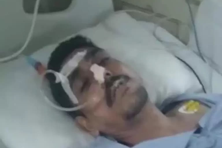 UP: Doctors remove 63 steel spoons from drug addict's stomach in Muzaffarnagar