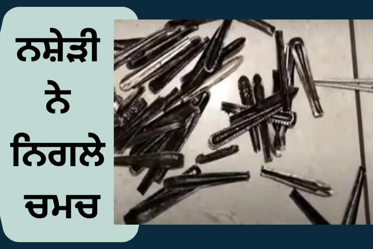 ਮੁਜ਼ੱਫਰਨਗਰ 'ਚ ਇਕ ਵਿਅਕਤੀ ਦੇ ਢਿੱਡ 'ਚੋਂ ਨਿਕਲੇ ਸਟੀਲ ਦੇ 63 ਚਮਚ