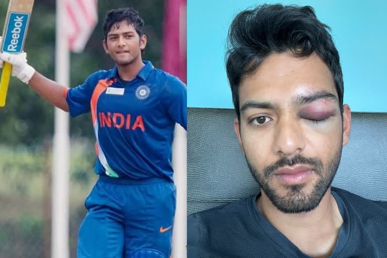Unmukt Chand suffers eye injury in US