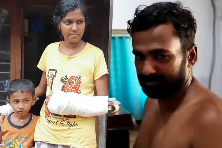 Husband cuts of the hand of Wife  Pathanamthitta  Kalanjoor  severly injured by the attack of her husband  wants to live happily with son  ഭര്‍ത്താവിന്‍റെ പീഡനത്തില്‍  കൈകള്‍ അറ്റുപോയ വിദ്യ  വിദ്യക്ക് ഇനി പ്രതീക്ഷ തന്‍റെ കുഞ്ഞ്  പത്തനംതിട്ട  കലഞ്ഞൂരിലെ  ഭാര്യ  ഭാര്യയെയും ഭാര്യപിതാവിനെയും  ഭർത്താവ് സന്തോഷ്‌  സന്തോഷ്‌  വിവാഹം  വിദ്യ