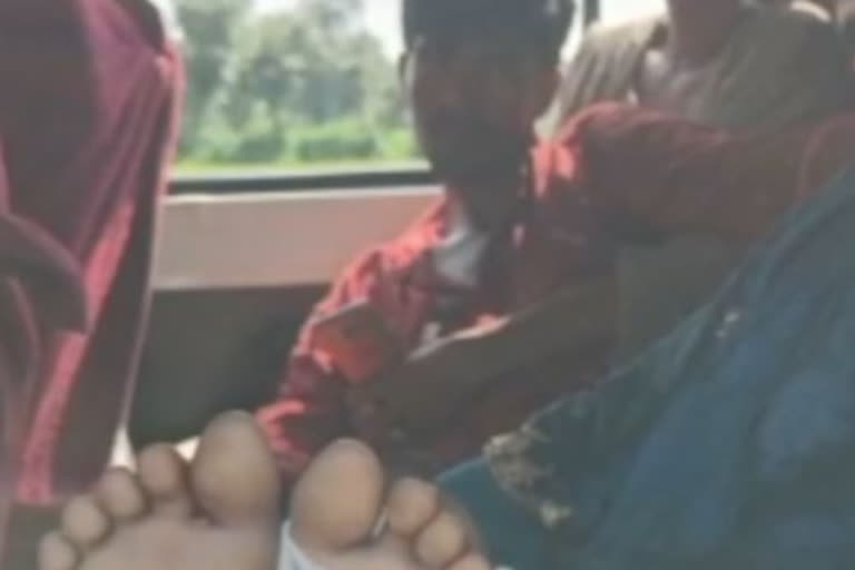 Nails hammered in man's feet over children dispute