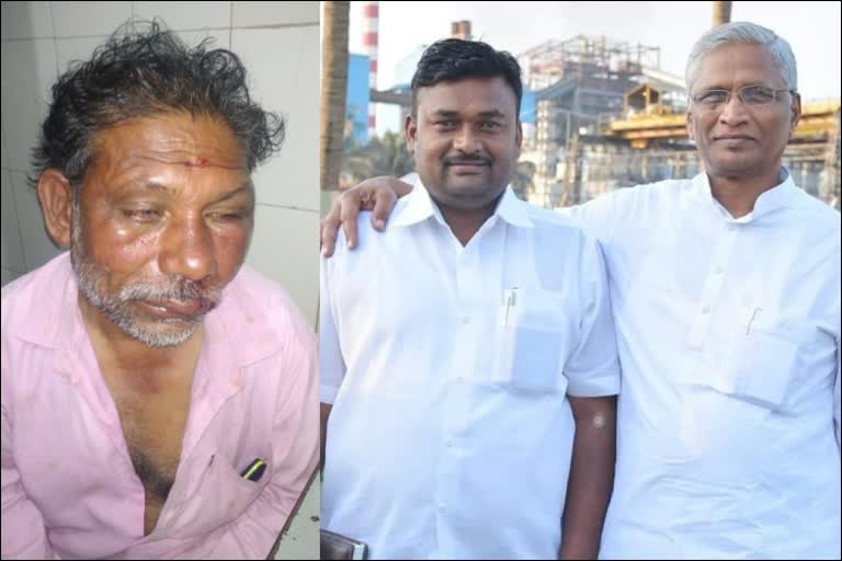 kagwad-mla-srimant-patil-close-aides-attacked-man-at-athani