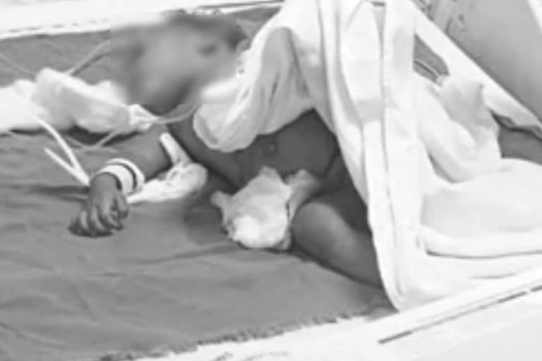 One-year-old boy attacked by three stray dogs in Noida's Lotus Boulevard Society died not responding to the treatment at a hospital in the national capital.