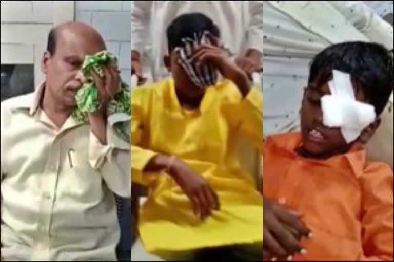 people suffer eye injuries  eye injuries due to Diwali crackers  eye injuries due to Diwali crackers in Telangana  Telangana dipawali tragedy  ದೀಪಾವಳಿ ಹಬ್ಬದಲ್ಲಿ ದುರಂತ  ಪಟಾಕಿ ಸಿಡಿಸುತ್ತಿದ್ದ 10 ಮಂದಿಗೆ ಗಾಯ  ಕಣ್ಣು ಕಳೆದುಕೊಂಡ ಬಾಲಕ  ದೀಪಾವಳಿ ಹಬ್ಬದಂದು ಪಟಾಕಿ ಸಿಡಿಸುತ್ತಿದ್ದ ವೇಳೆ ದುರಂತ  ಎಚ್ಚರ ವಹಿಸಿದ್ರೂ ದುರಂತಗಳು ಸಂಭವಿಸುತ್ತಲೇ ಇರುತ್ತವೆ  ಪಟಾಕಿ ಹಚ್ಚುವ ವೇಳೆ ಮುಂಜಾಗ್ರತ ಕ್ರಮ