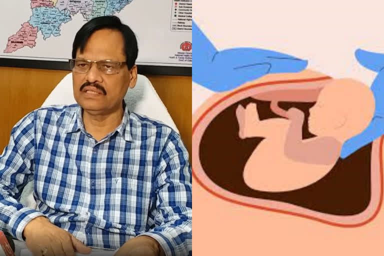 Cesarean Delivery: ରାଜ୍ୟରେ ବଢୁଛି ସିଜରିଆନ, ଆଗରେ ରହିଛି ଖୋର୍ଦ୍ଧା