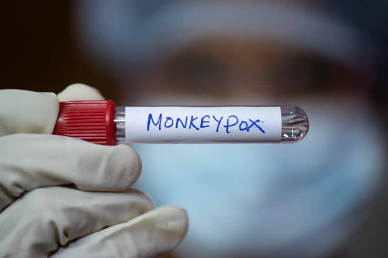 monkeypox disease in children