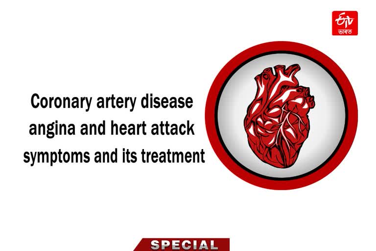 Coronary artery disease angina and heart attack symptoms and its treatment