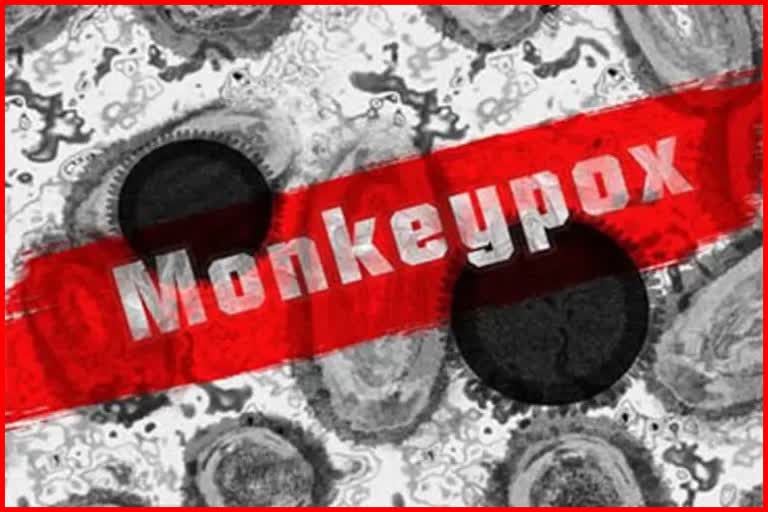 monkeypox