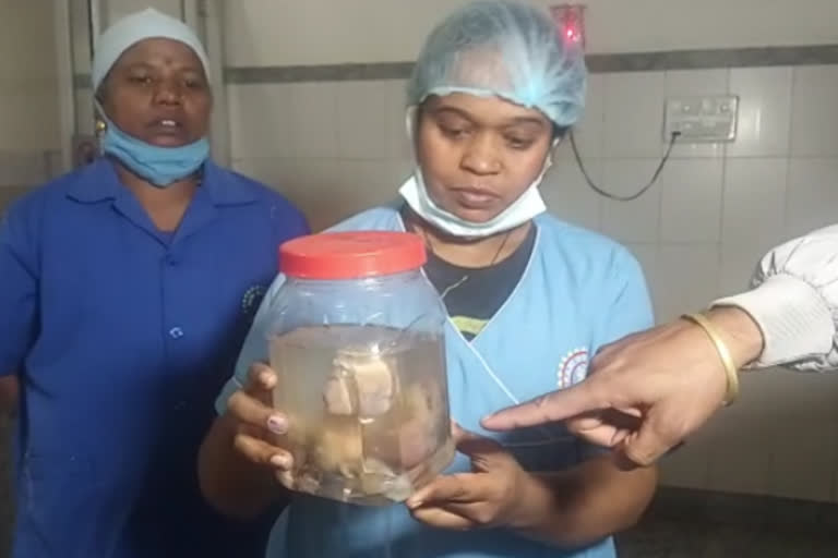 Eight fetus from stomach of Newborn