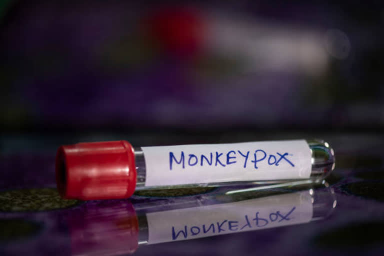 Scientists find evidence of 'substantial' transmission of monkeypox even before symptoms appear