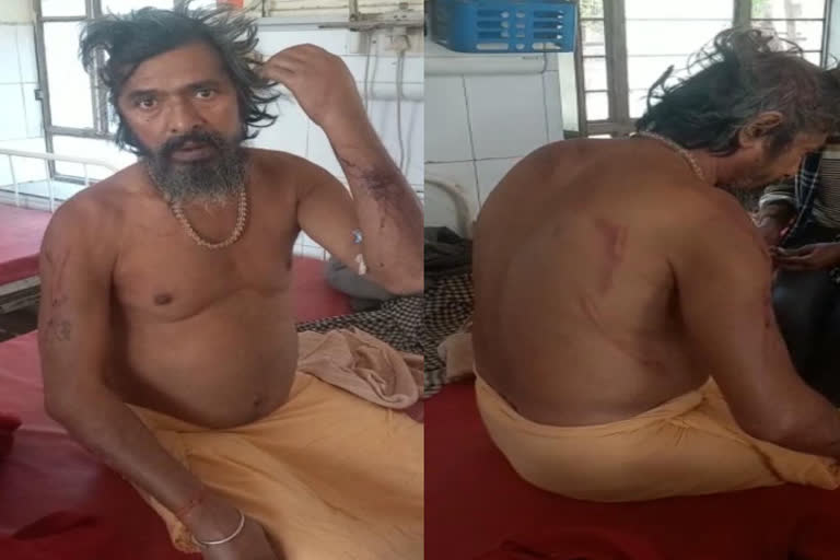 Gravel mafia attacked sadhu and his family in Dholpur