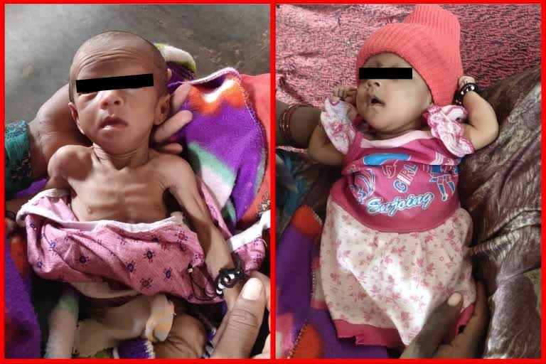 Melghat Malnutrition