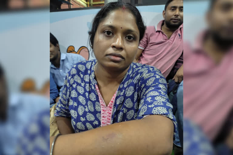 female-cop-bite-job-aspirant-in-a-bizarre-incident-at-protest-site-at-exide-junction