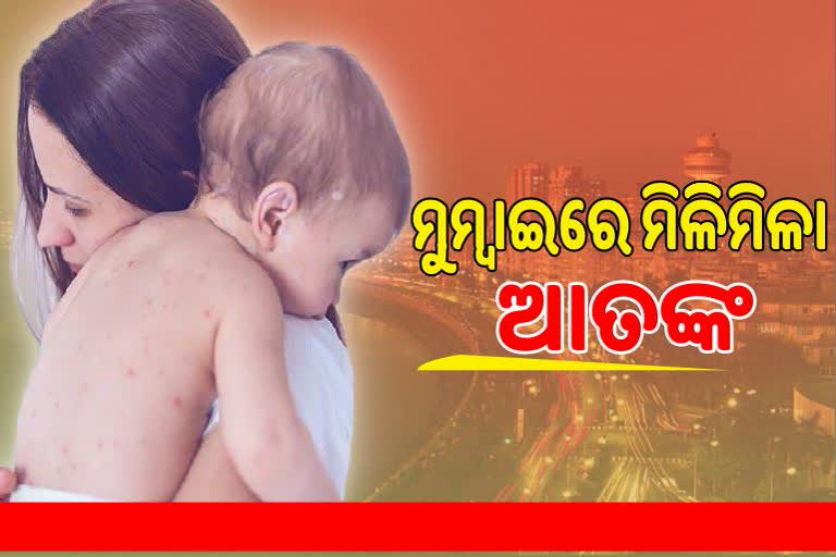 Measles Outbreak In Mumbai: ମିଳିମିଳାରୁ ପିଲାଙ୍କୁ କିପରି ଦେବେ ସୁରକ୍ଷା ? ଜାଣନ୍ତୁ ରୋଗର କାରଣ ଓ ନିରାକରଣ