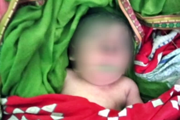 Baby born with a trunk-like structure instead of nose grabs people's attention